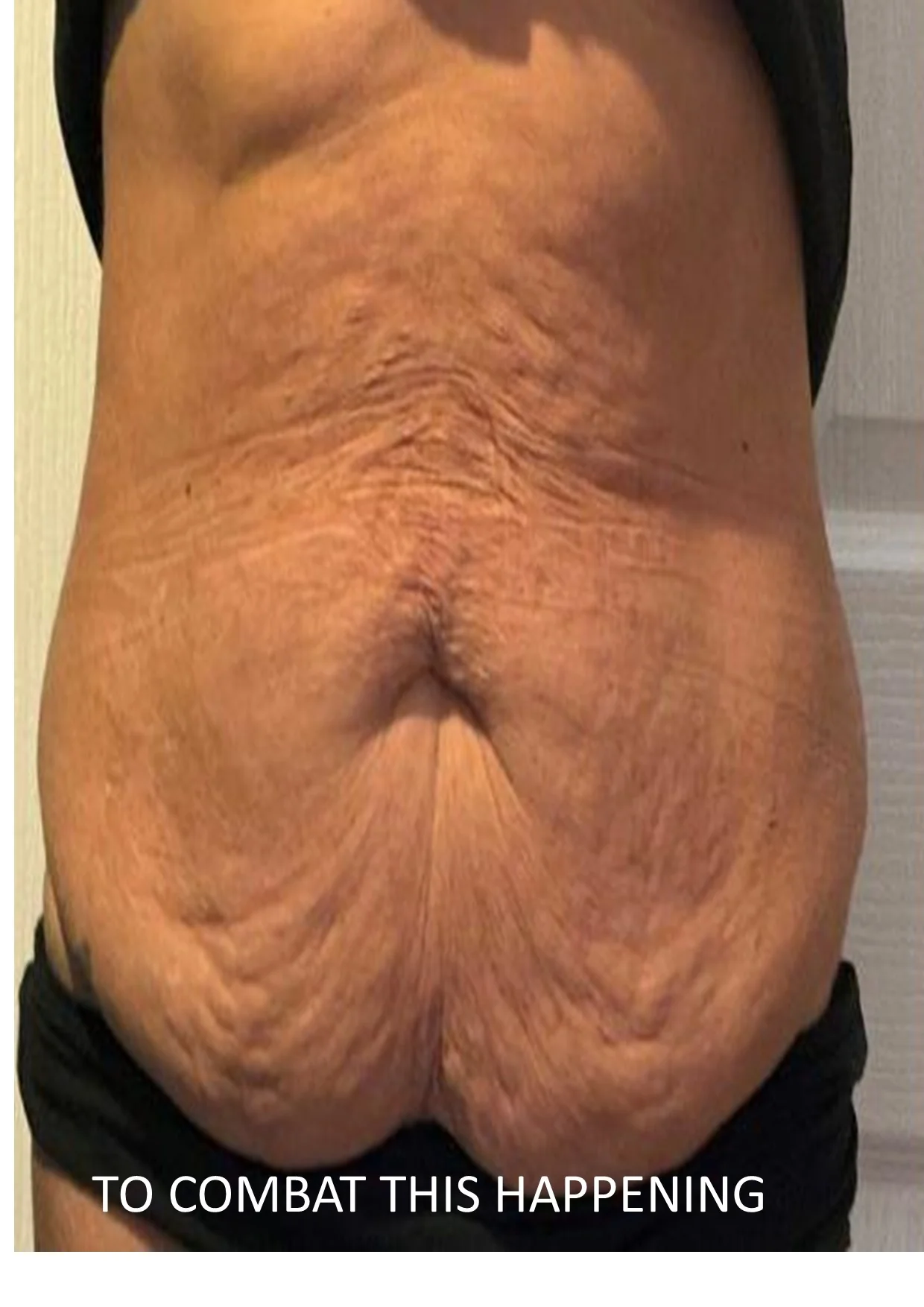 Firming Body Serum NES159 200ml - Image 3