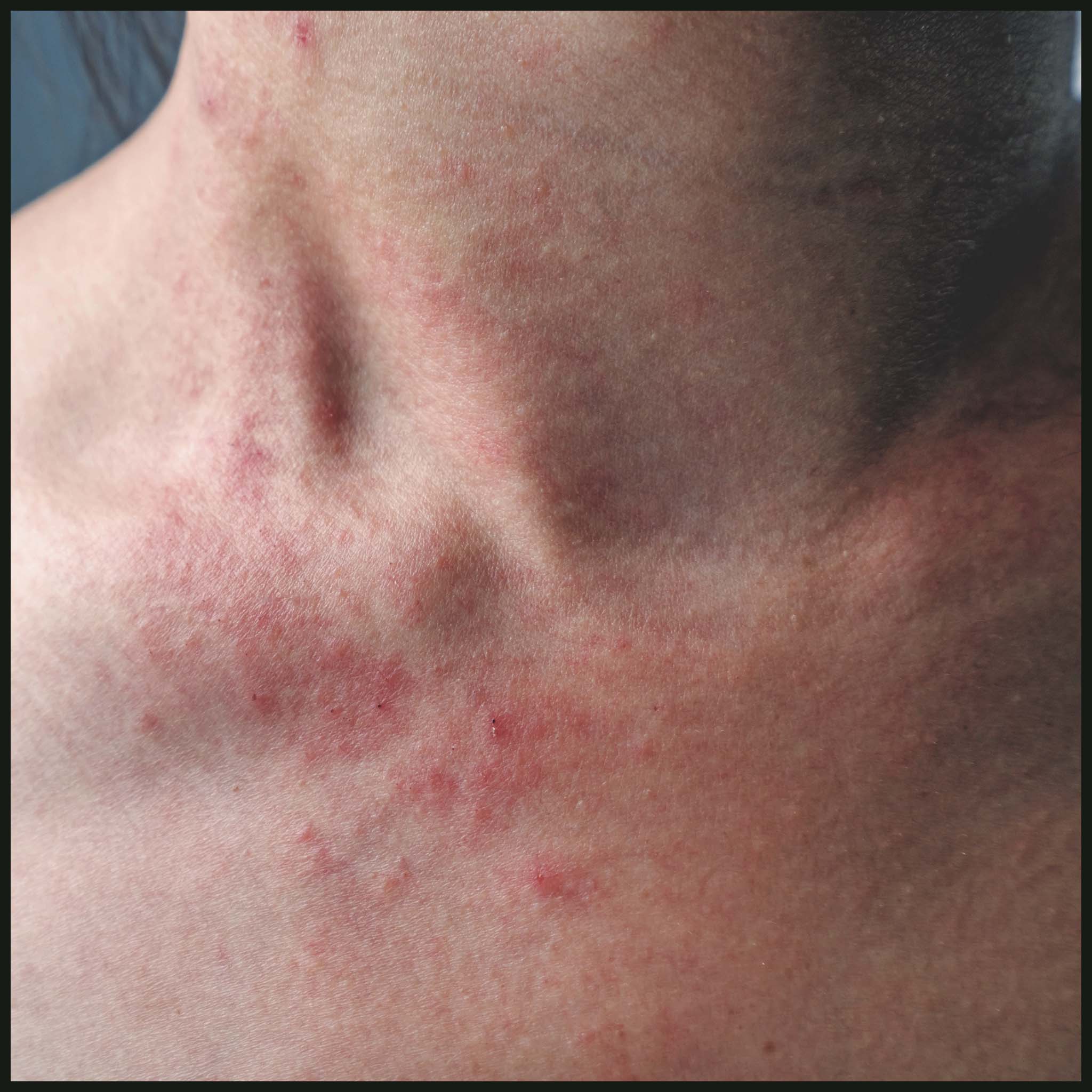 Hydrating Facial Oil 50ml |  Anti-Ageing For Sensitive Skin | NES133 - Image 3