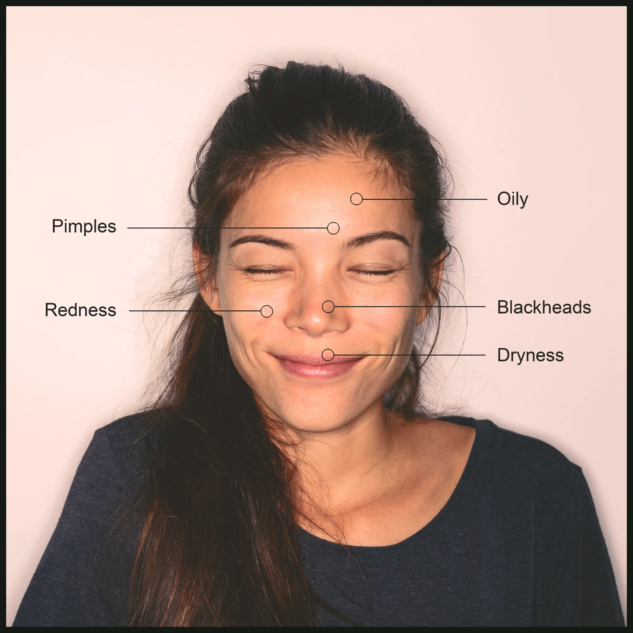 Detoxing Face Wash & Eye Make-Up Remover 200ml | For Oily & Acne Prone Skin | NES001 - Image 4